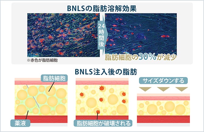 BMLSの脂肪溶解効果の図