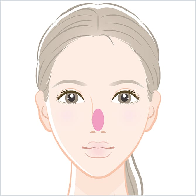 BNLS注射の鼻の施術箇所の図