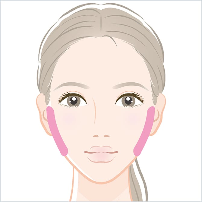 BNLS注射のフェイスラインの施術箇所の図