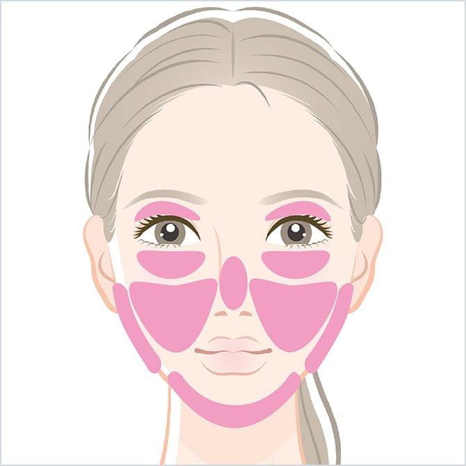 BNLS注射の顔全体の施術箇所の図