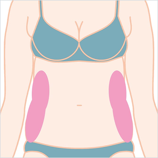 BNLS注射のウエストの施術箇所の図