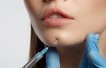 ヒアルロン酸注入