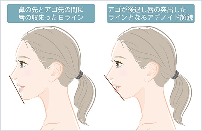 美しい横顔の指標とされる「Eライン」