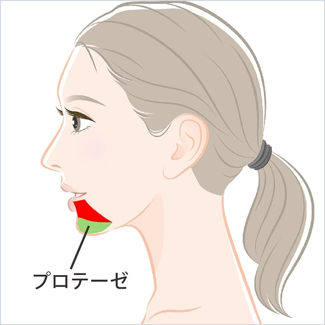 顎にプロテーゼを挿入