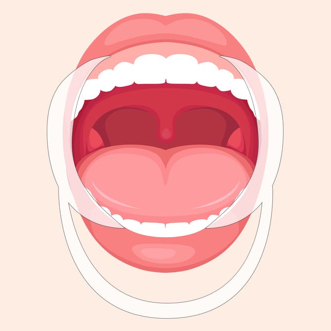 内側法のテーピングイメージ