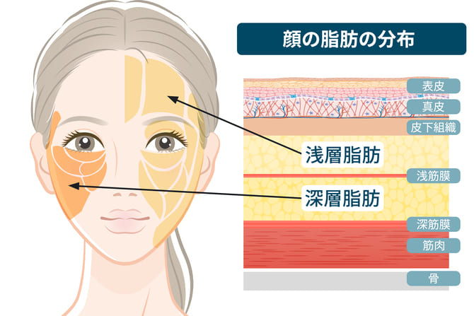 吸引する脂肪層の説明図