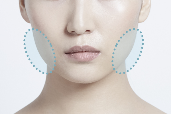 エラ骨切り・骨削り術