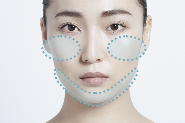 輪郭3点(小顔形成術)