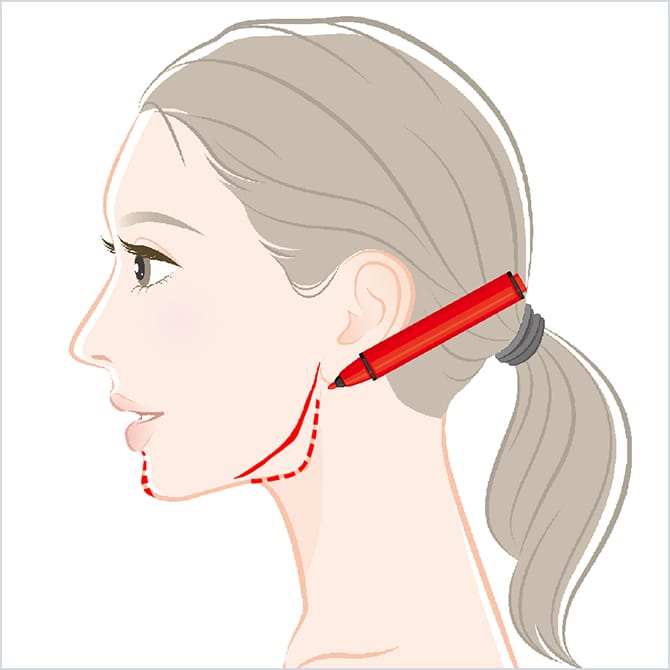 超音波骨切り術による輪郭形成 美容整形外科のジョウクリニック