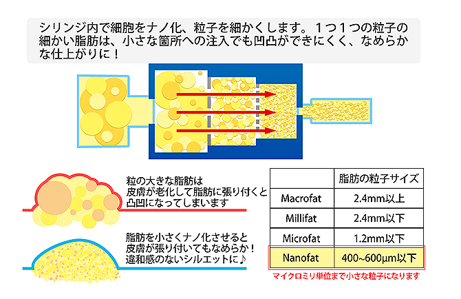 シリンジ内で脂肪細胞をナノ化する図