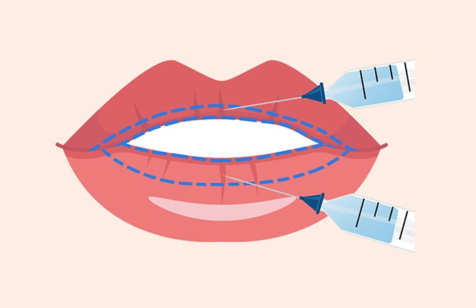 唇に麻酔するイラスト