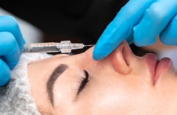 ヒアルロン酸注入