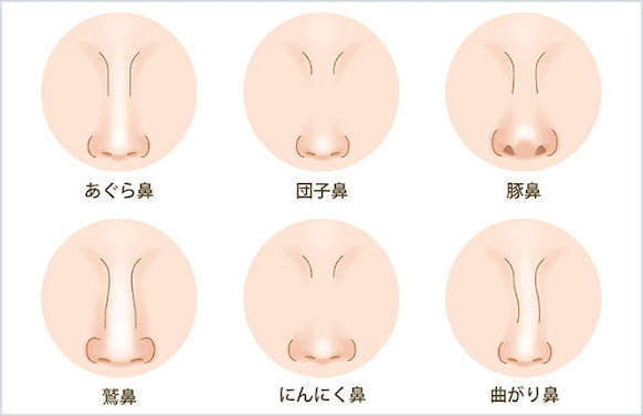 それぞれの鼻のお悩み