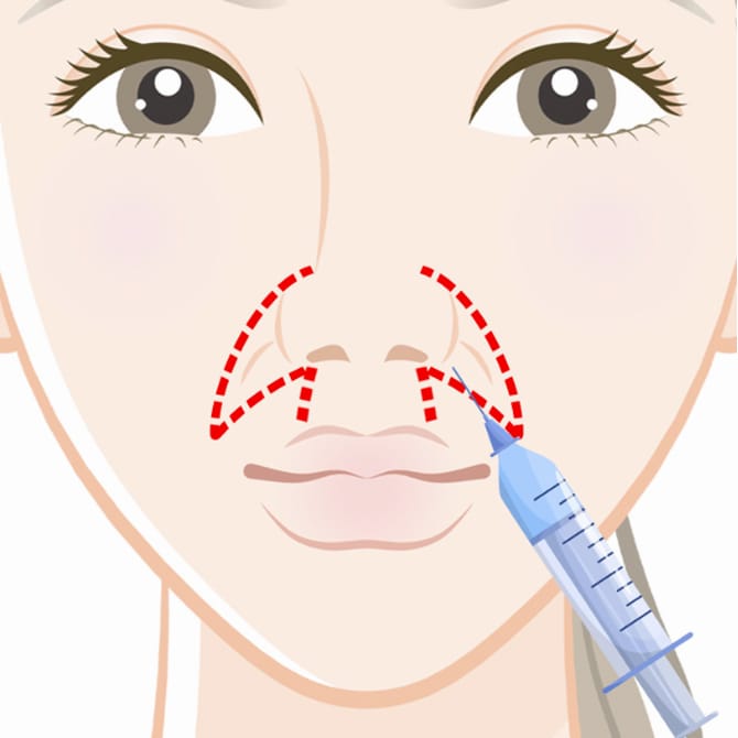 局所麻酔するイメージ