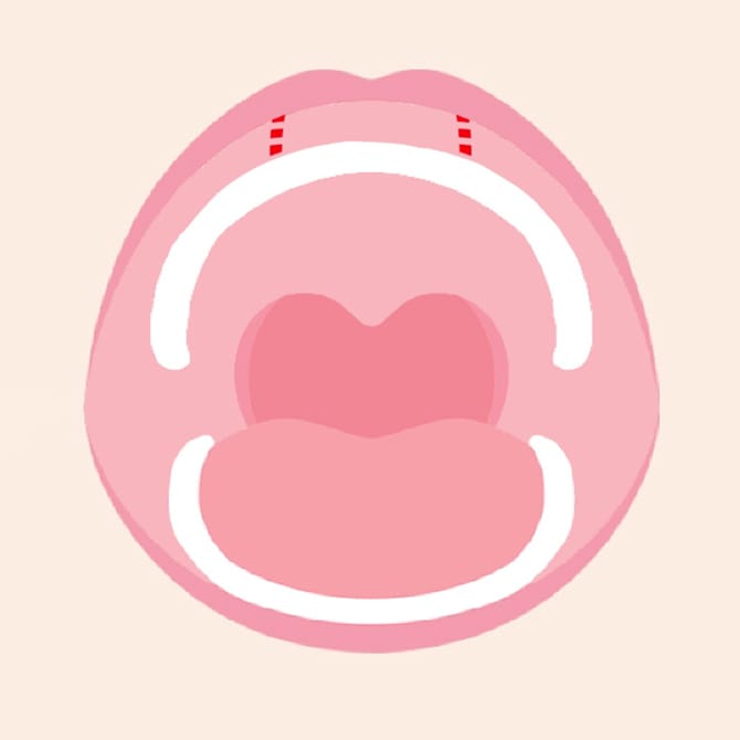 口の中の切開図