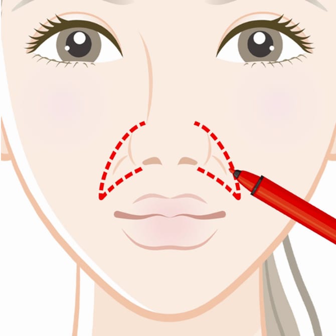 鼻翼基部にマーキングする図