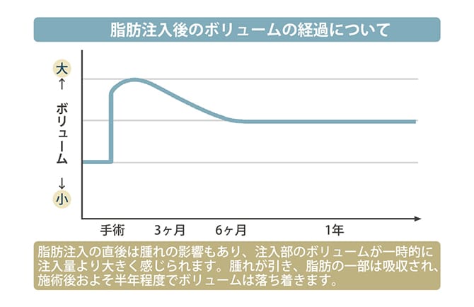 脂肪注入後のボリュームの経過グラフ