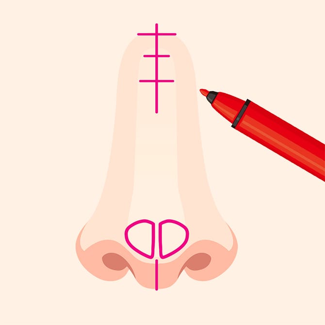 鼻にマーキングする図