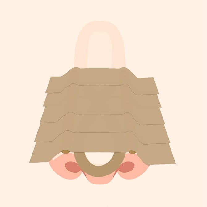 自家組織移植鼻尖形成術のの施術完了