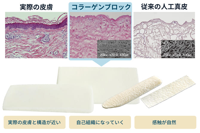 コラーゲンブロック