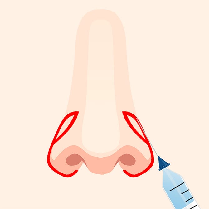 鼻に麻酔するイメージ