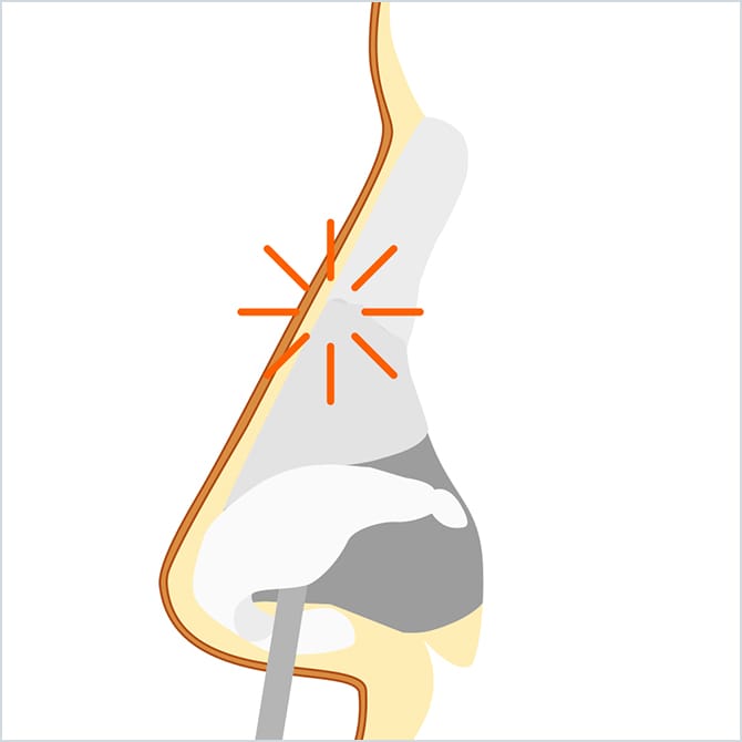 鼻筋を調整するイメージ