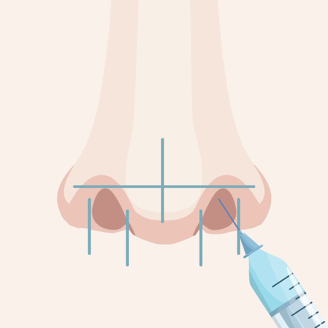麻酔のイメージ