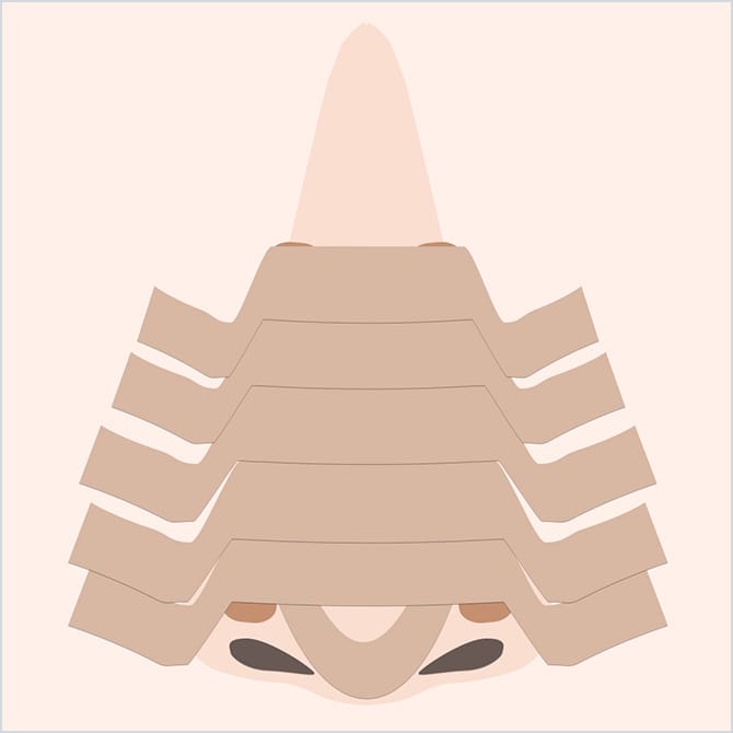 鼻にギプスをする図