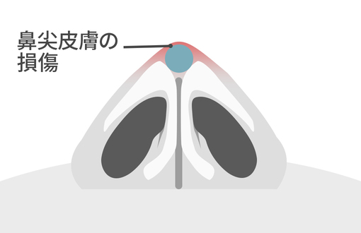 鼻尖皮膚の損傷