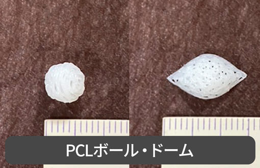当院で実際に抜去したオステオポール