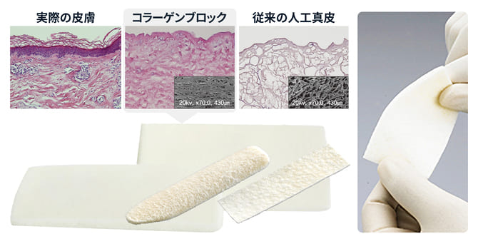 体に馴染む素材での皮膚の補強