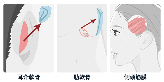 自家組織で再手術