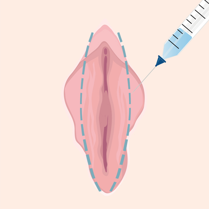 デザイン・麻酔