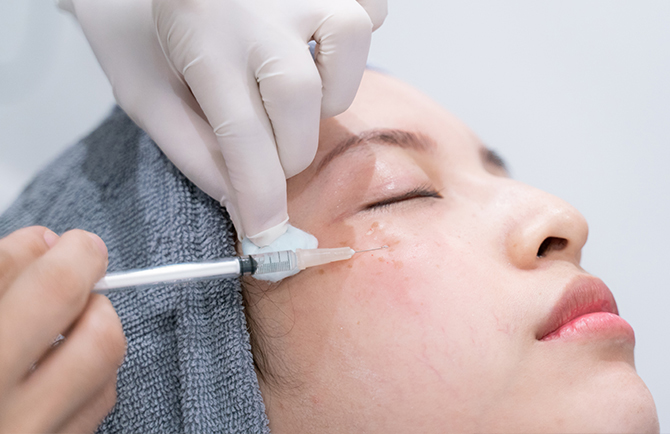 適切な注入によって最大限の効果を発揮