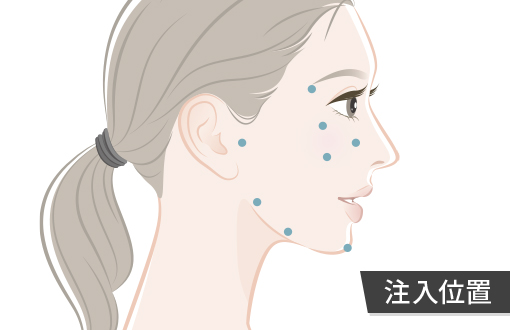 ジャルプロ スーパーハイドロの注入位置