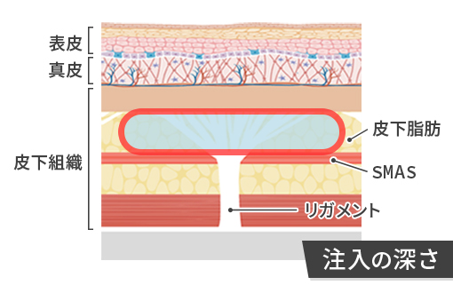 ジャルプロ スーパーハイドロの注入の深さ