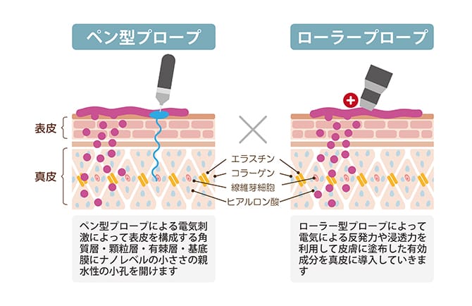 ペン型プロープとローラープロープ