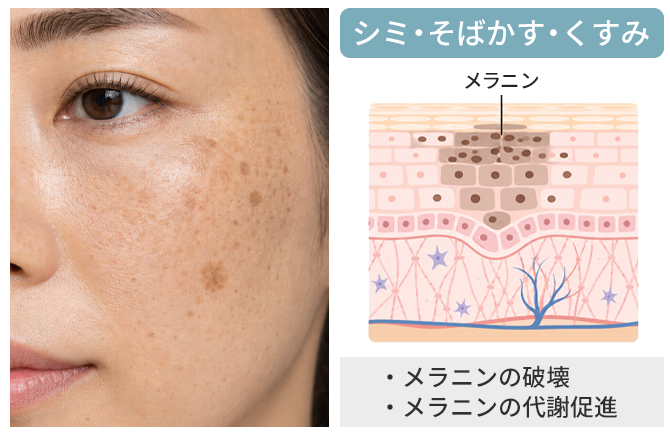 メラニンに働きかけ、澄んだ肌へ