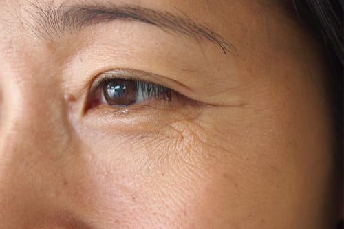 シワを改善してエイジングケアに