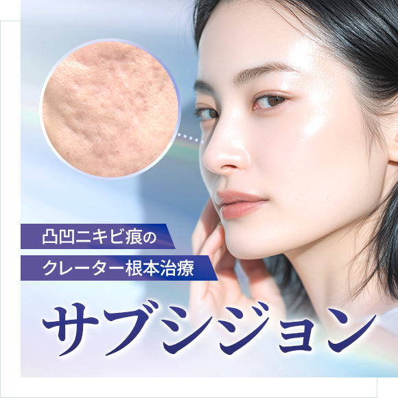 サブシジョン(ニキビ痕・クレーター治療)