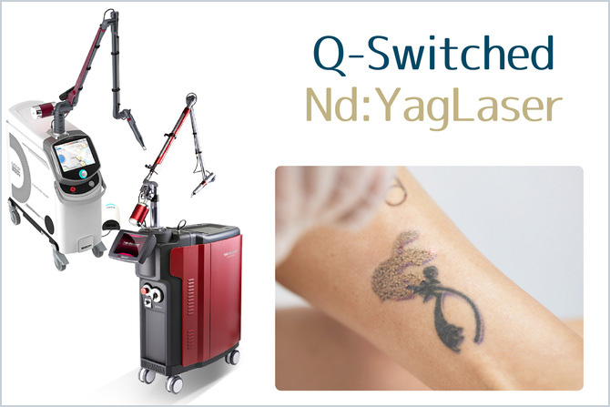 QスイッチYAGレーザー