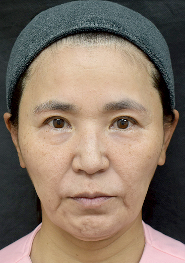 50代女性顔画像 