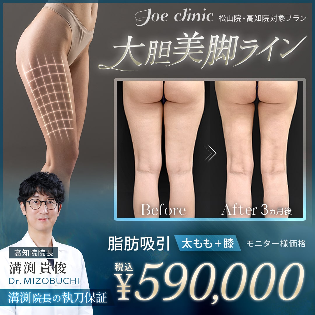 脂肪吸引