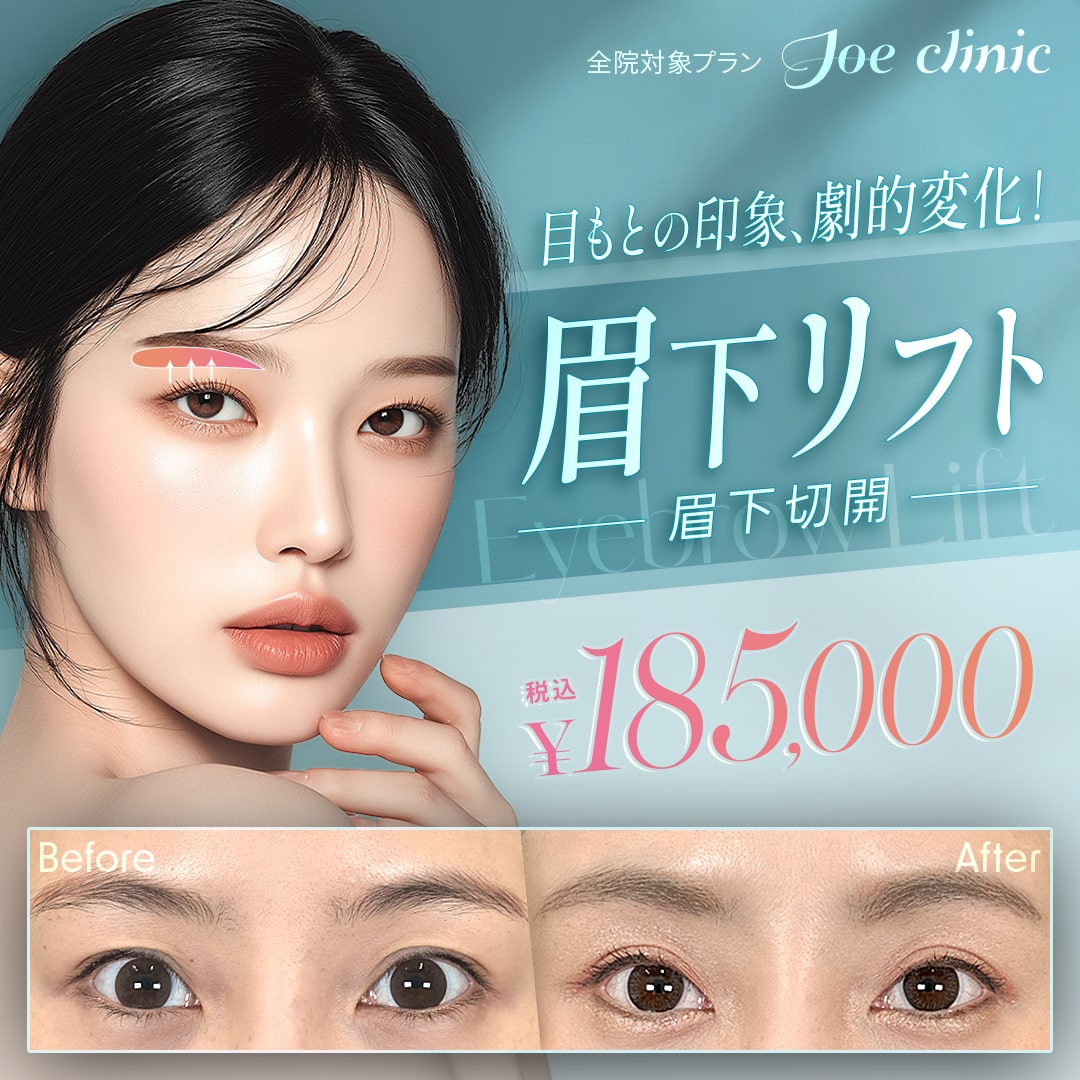 眉下リフト（眉下切開法） 全院対象プラン