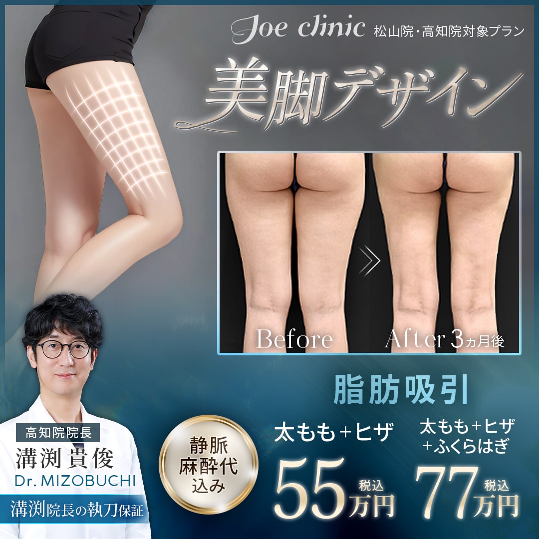 脂肪吸引