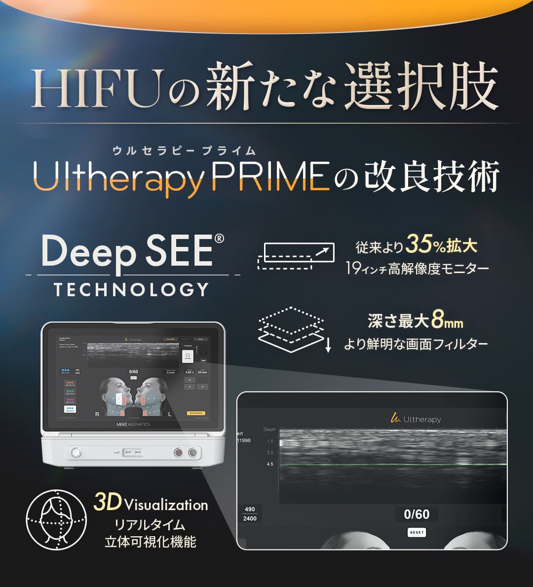 新導入！ウルセラピープライム