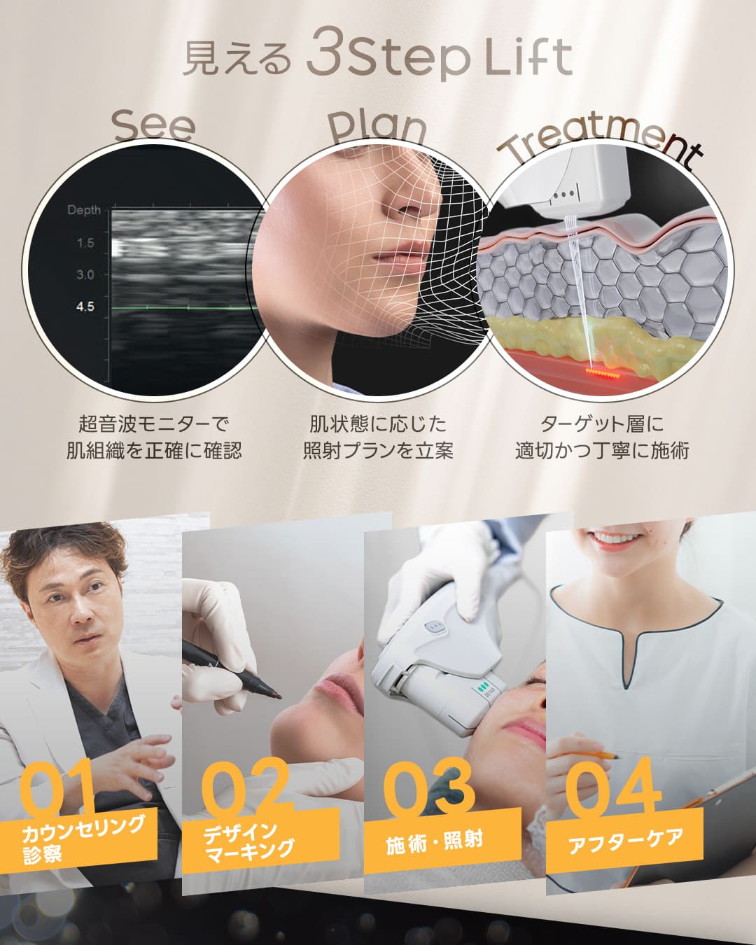 新導入！ウルセラピープライム