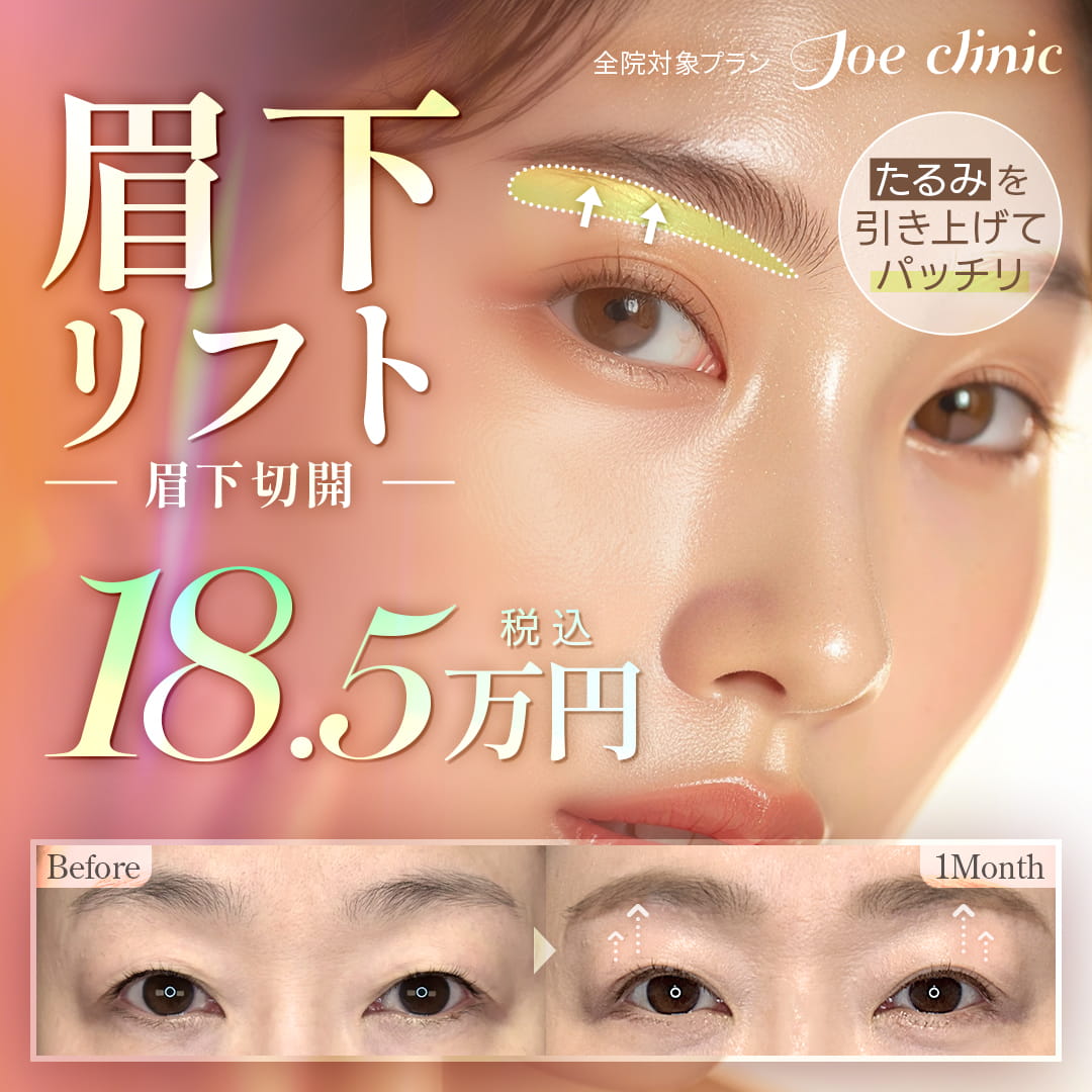 眉下リフト（眉下切開法） 全院対象プラン