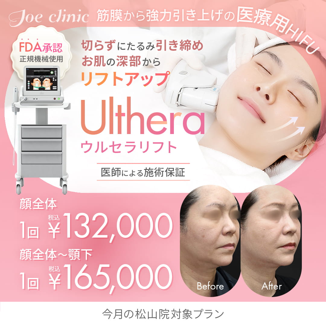 ウルセラリフト 松山院対象プラン