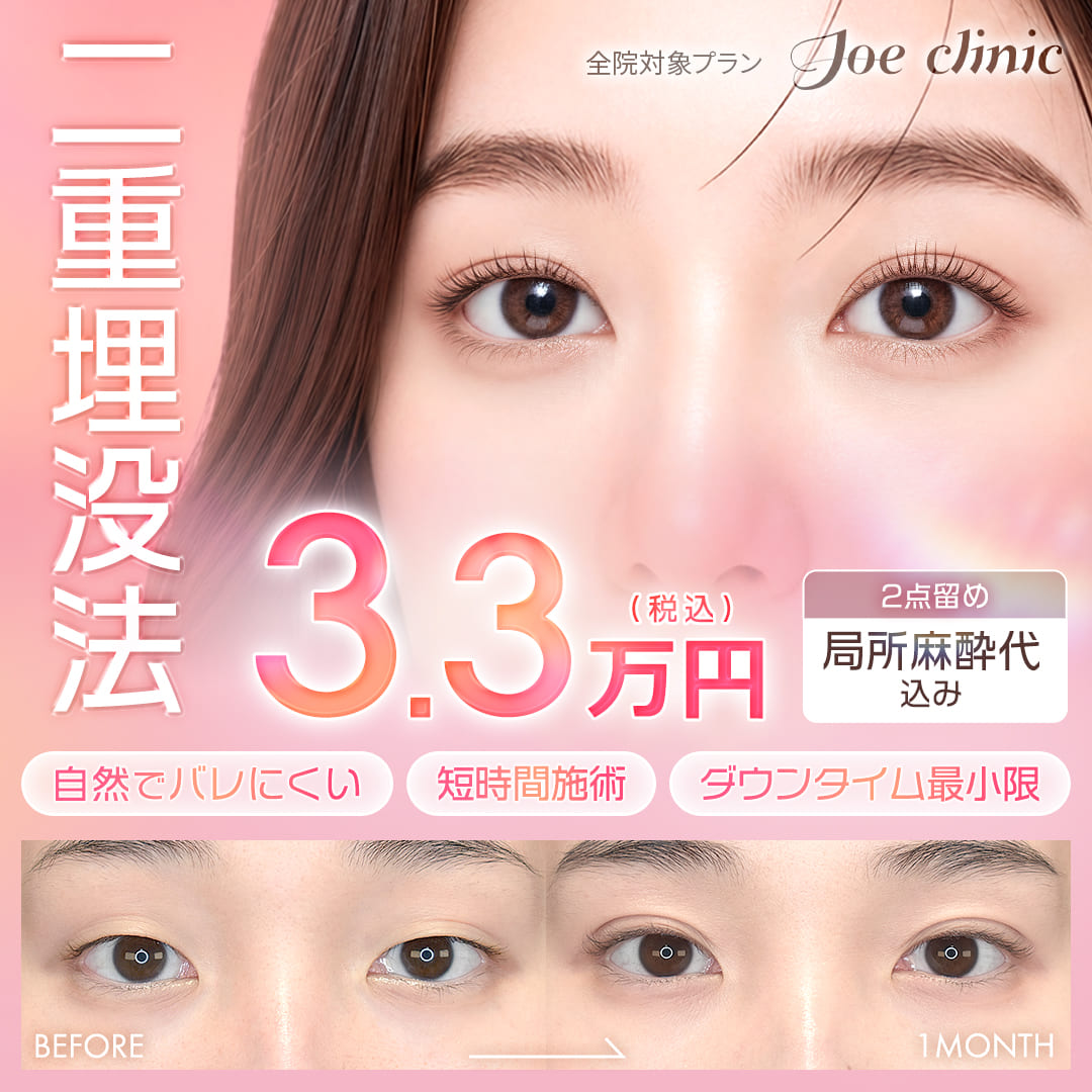 二重埋没法 全院対象プラン